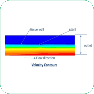 CFD modelling of Drug Release through Stent-featured